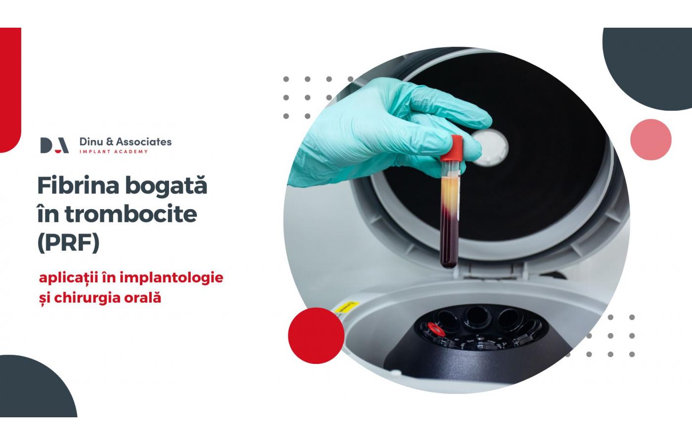 PRF (Platelet-Rich Fibrin): aplicații în implantologie și chirurgia orală 