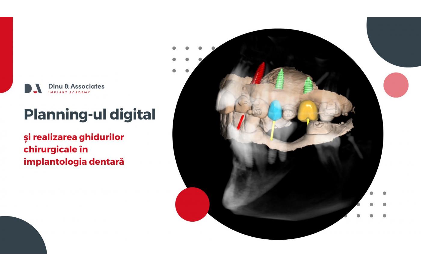 Planning-ul digital și realizarea ghidurilor chirurgicale în implantologia dentară
