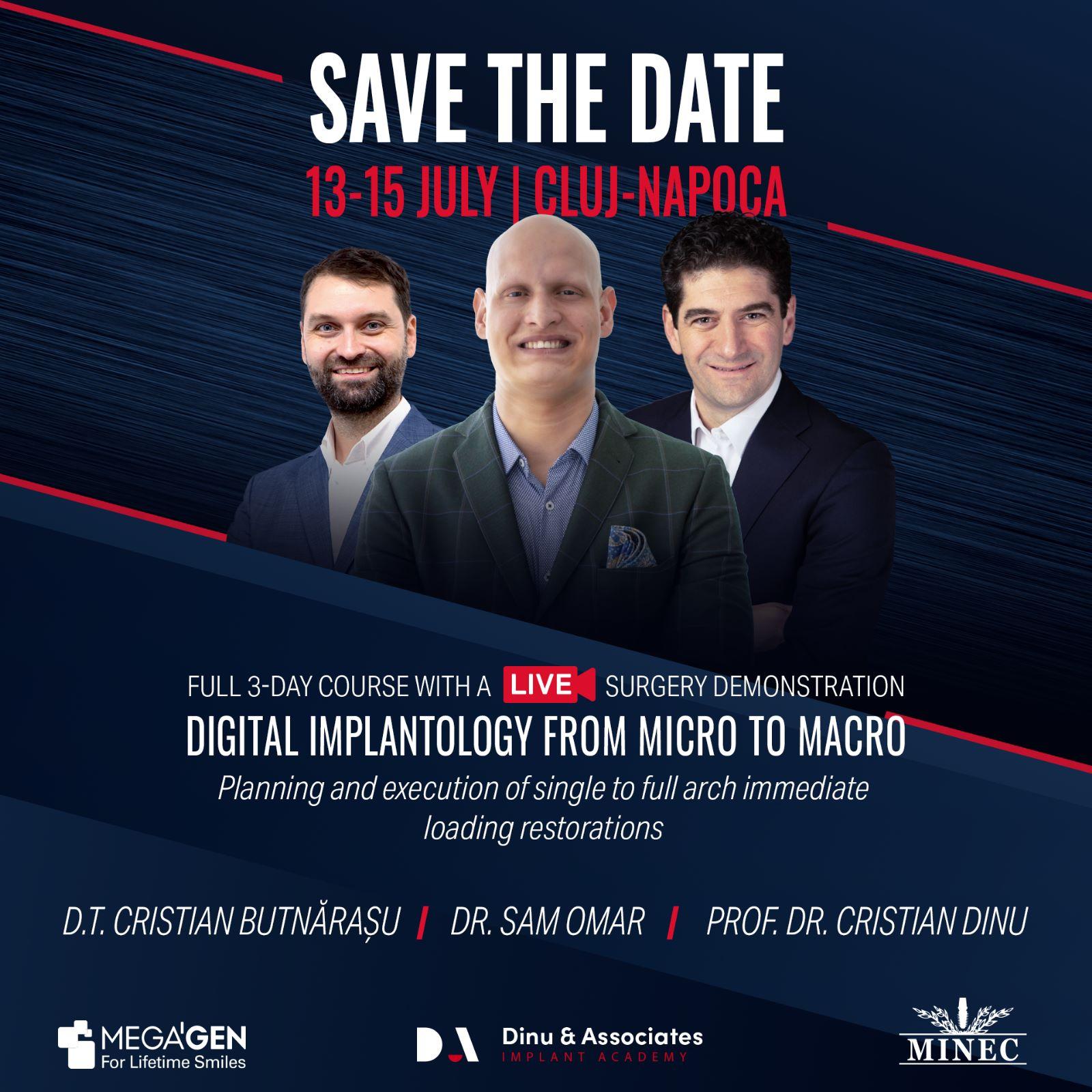 Digital implantology from micro to macro
